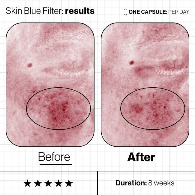 Skin Blue Filter 60st-Advanced Nutrition Programme-Schoonheidsinstituut Leanne Paulissen