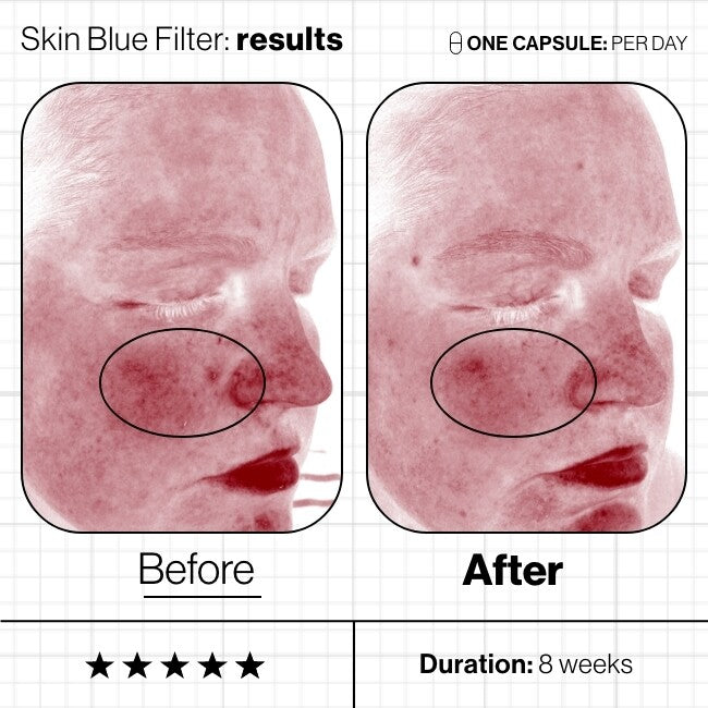 Skin Blue Filter 60st-Advanced Nutrition Programme-Schoonheidsinstituut Leanne Paulissen
