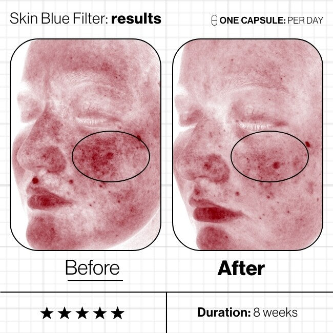 Skin Blue Filter 60st-Advanced Nutrition Programme-Schoonheidsinstituut Leanne Paulissen